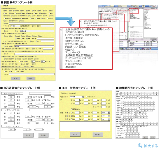 簡単テンプレートで一発入力。